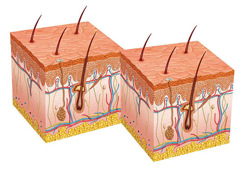 Трихология в СПБ - срез кожи, луковица волоса Трихология в СПБ - срез кожи, луковица волоса